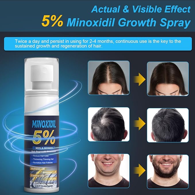 Click to see full view 5% Minoxidil for Men and Women, Hair Growth Biotin Serum with Batana and Rosemary for Hair beard Regrowth Treatments, Extra Strength Hair Loss Solution to Regrow Thicker, 2.02FL OZ